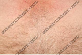 photo texture of hairy skin